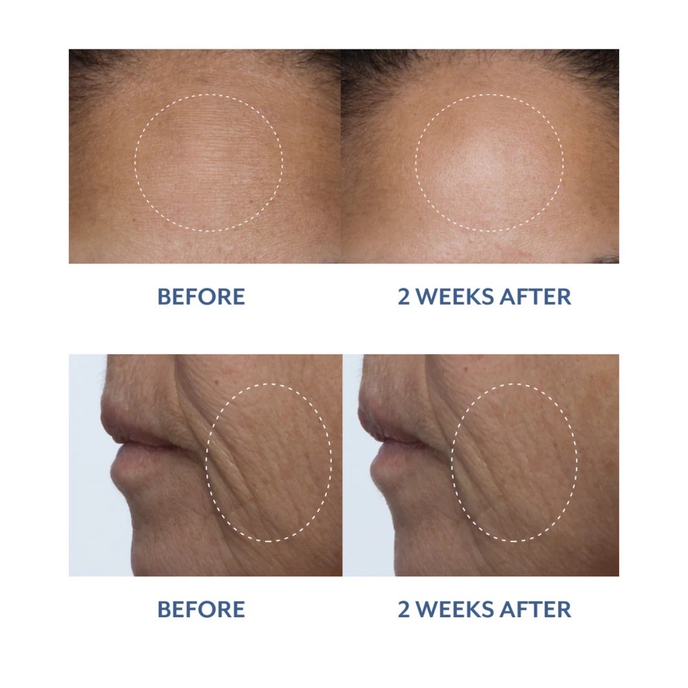 Bloomeffects Black Tulip Facial Treatment